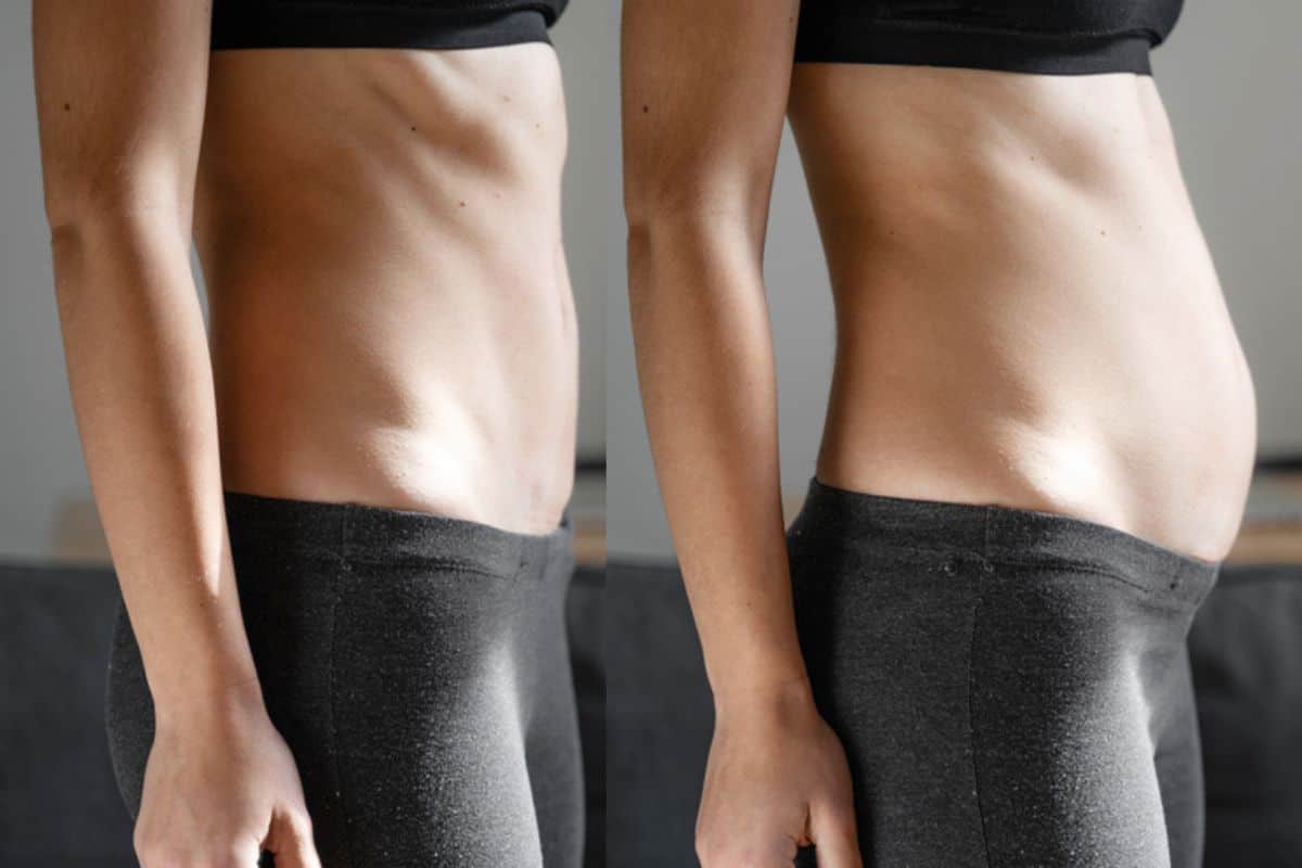 How long does diastasis recti take to improve Billingshurst?