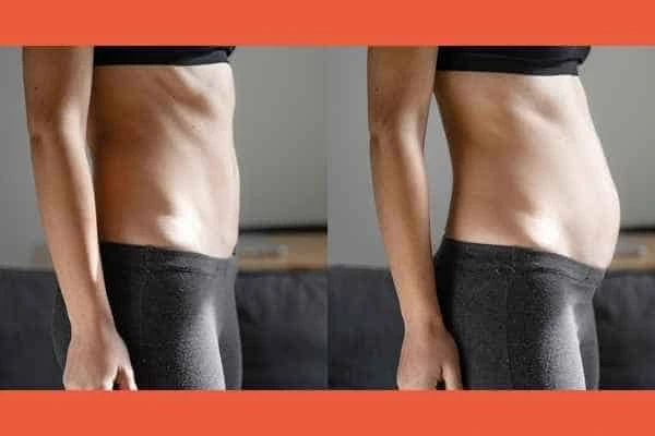LA-EMS Body Sculpting results Billingshurst