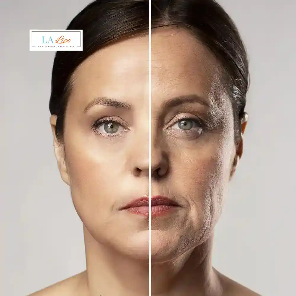 How Can You Tell If Non-Surgical Skin Tightening Is Right for You Billingshurst?