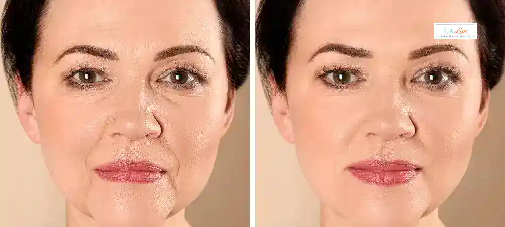 Why Aren’t My Skincare Products Making My Sagging Skin Look Firmer Billingshurst?