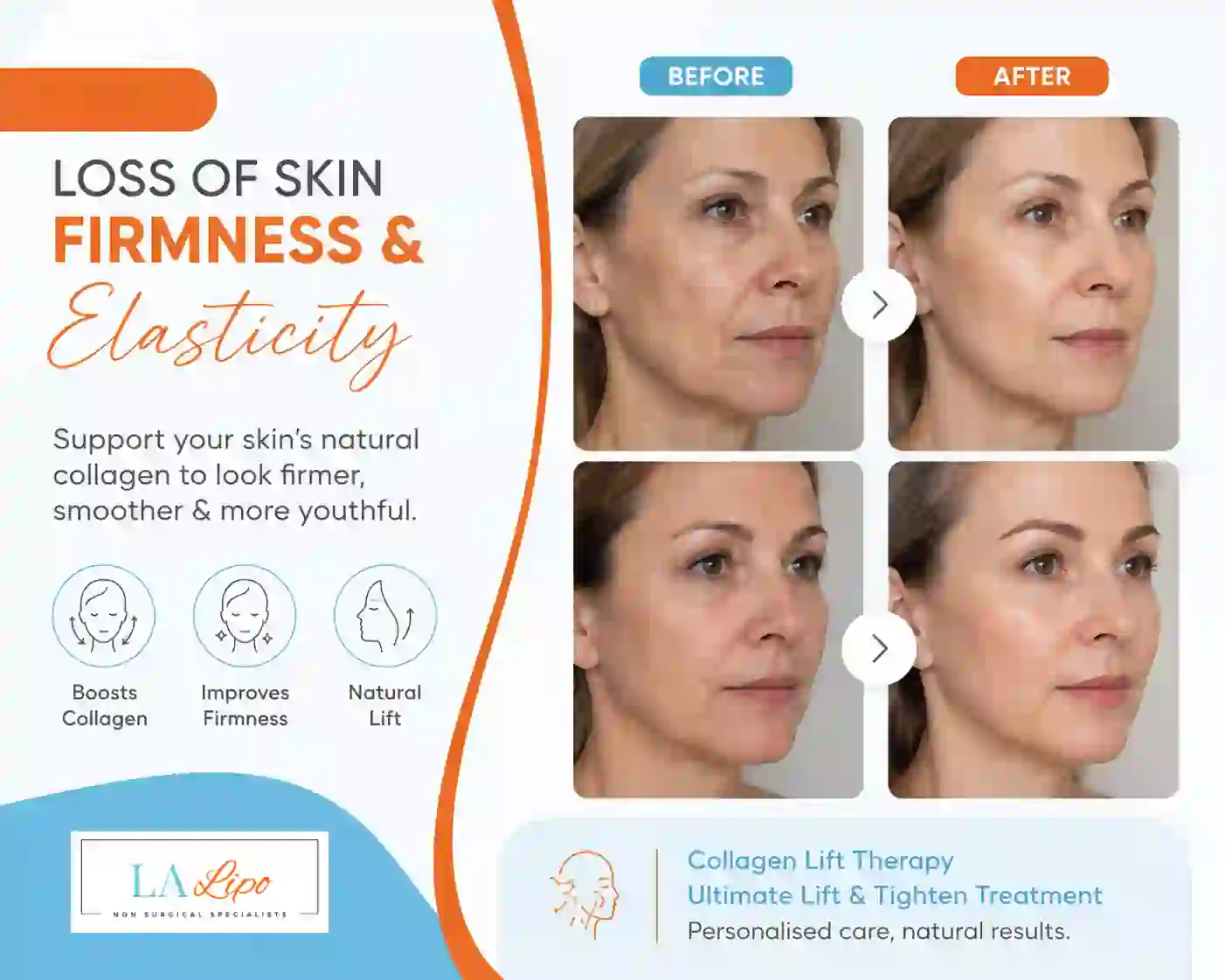 Sign #7: Loss of Skin Firmness and Elasticity Billingshurst
