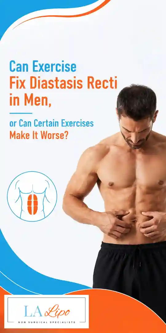 Can Exercise Fix Diastasis Recti in Men, or Can Certain Exercises Make It Worse Billingshurst?