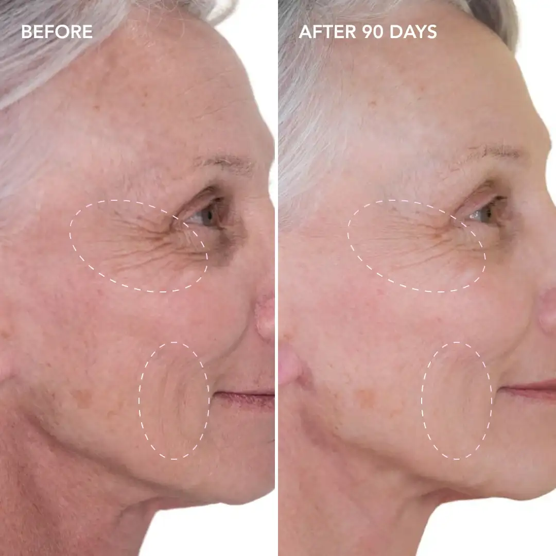 When will you see results Billingshurst